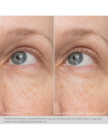 DAILY HYDRO-DROPS® REJUVENATING EYE GEL CREAM