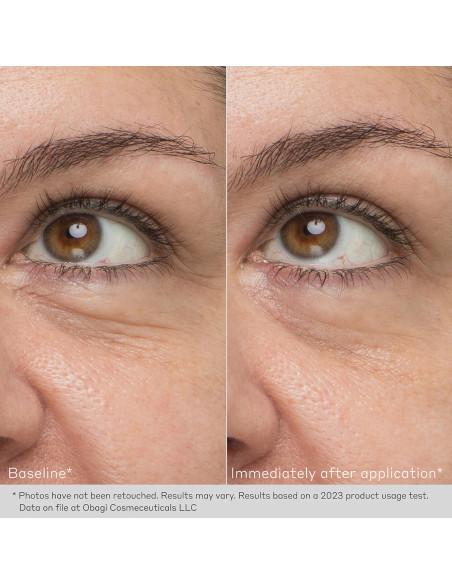 DAILY HYDRO-DROPS® REJUVENATING EYE GEL CREAM