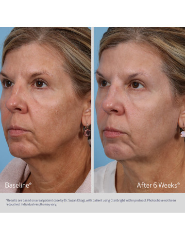 Obagi Medical SUZANOBAGIMD™ Claribright