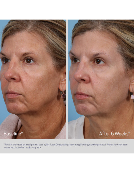 Obagi Medical SUZANOBAGIMD™ Claribright Obagi Medical SUZANOBAGIMD™ Claribright
