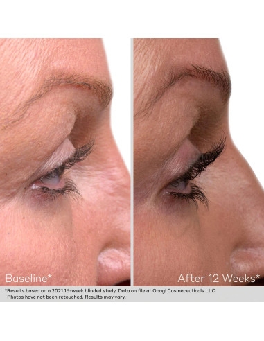 Kit Obagi Duo Nu-Cil™