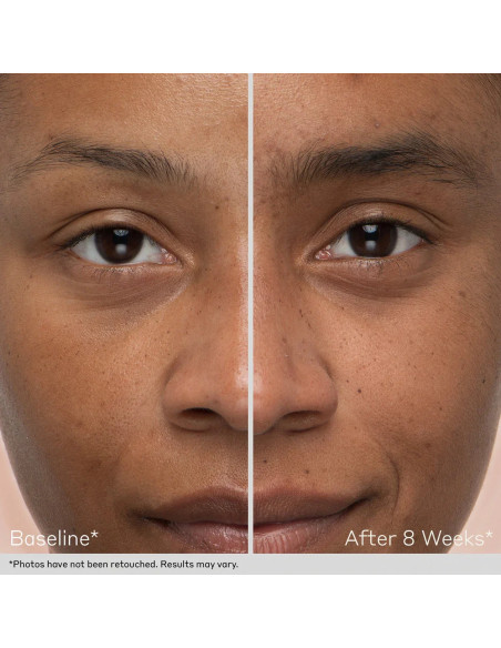 Kit Obagi Duo Nu-Cil™