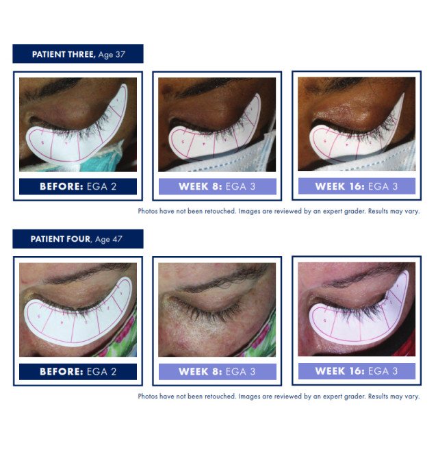 OBAGI NU-CIL™ EYELASH ENHANCING SERUM