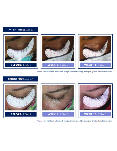 OBAGI NU-CIL™ EYELASH ENHANCING SERUM